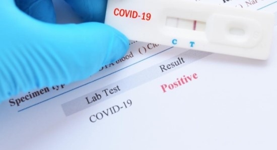 3869 са новите случаи на коронавирус